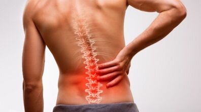 Dấu hiệu và triệu chứng của bệnh xương khớp xương sống