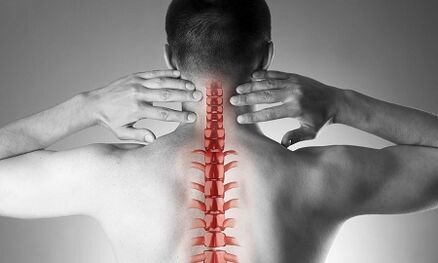 Viêm xương sụn cột sống cổ biểu hiện như thế nào